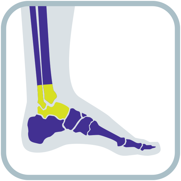 Foot and Ankle Pain